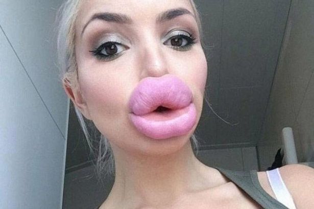 best of Lips huge plump