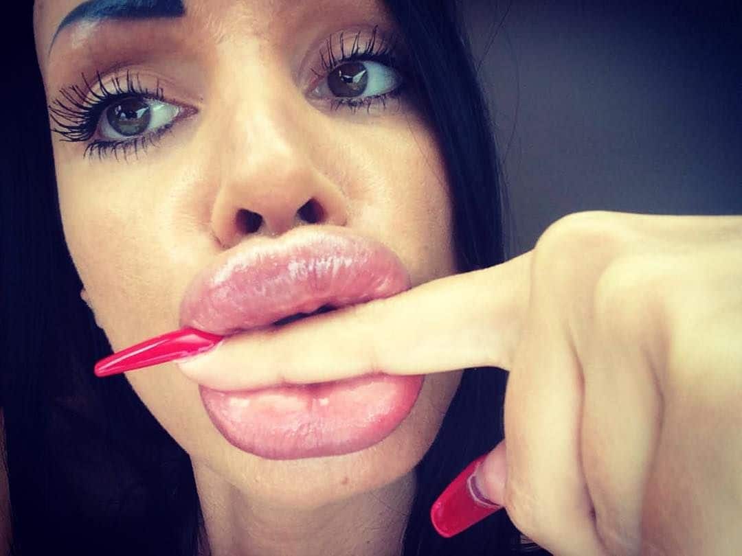 Armani reccomend fake lips milf close tease