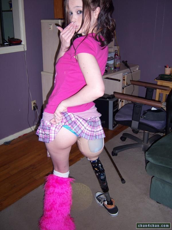 Amputee using sexy prosthesis